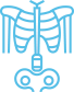 skeletal abnormalities